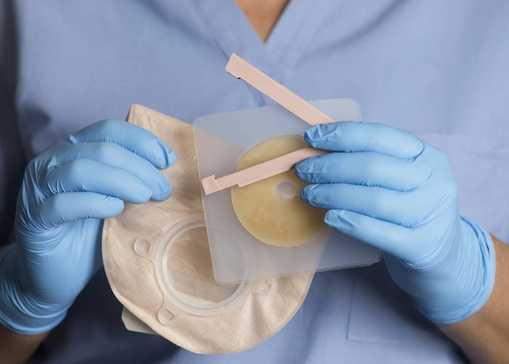 Colostomy Bag Changing Noble Care Malaysia